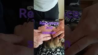 Rejuvance face lift massage