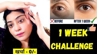 आंखों के नीचे गड्ढे,धंसी हुई आंखें, Dark circles & Wrinkles को 7 दिन में गायब करने का रामबाण नुस्खा