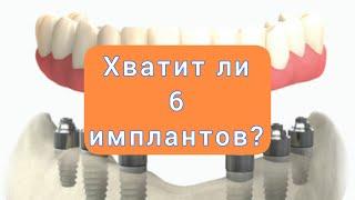 Протезирование на 6 ИМПЛАНТАХ. Несъемный протез на 6 имплантах.