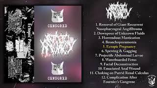 Ectopic Pregnancy - s/t MC FULL EP (2024 - Goregrind)