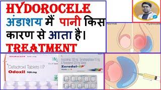 HYDROCELE के कारण/लक्षण/इलाज/TREATMENT OF HYDROCELE/HYDROCELE की दवाई/BEST MEDICINE FOR HYDROCELE