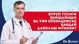 Бурун тусиғи қийшайиши ва уни операциясиз қандай даволаш мумкин?