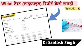 How To Read Widal Test Report? Typhoid | Dr Santosh Singh | (Episode 18)