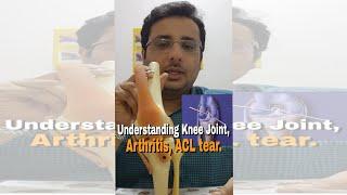 Knee Joint Anatomy, Arthritis And ACL tear.