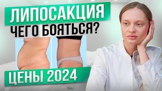 Что Такое Липосакция? Сколько Стоит Липосакция в 2024?