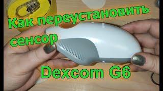 Как переустановить сенсор Dexcom G6. Полное видео в реальном времени.