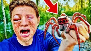 DEADLY SPIDER BIT ME!! *allergic reaction *