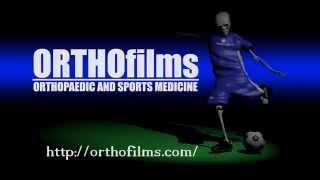 ORTHOfilms Trailer