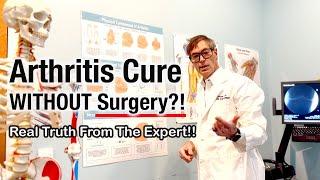 Stem Cells Over Surgery? Dr. Yeargan's Arthritis Cure Revolution!