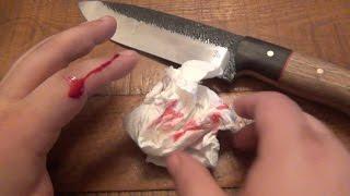 Cutlerylover Cut Himself...Go Figure