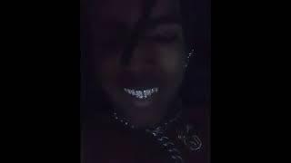 xxxtentacion showing off his grills