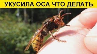 УКУС ОСЫ: ЧТО ДЕЛАТЬ? ПЕРВАЯ ПОМОЩЬ, ПОСЛЕДСТВИЯ ОТ УКУСА ОТ ОСЫ