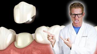 Dentist Explains "What is a Dental Crown?" & "Why Do You Need A Crown?" - Tooth Cap Guide