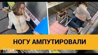 ШОК! ЖЕНЩИНЕ АМПУТИРОВАЛИ НОГУ. Траволатор зажевал ногу пассажирки в аэропорту