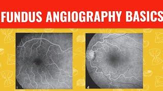 FFA course  || FUNDUS FLUORESCEIN ANGIOGRAPHY ||