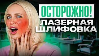 ШОК! Осложнения после лазерной шлифовки СО2, к которым вы НЕ готовы