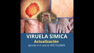 Actualización de Viruela Simica