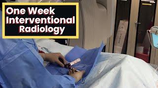 One Week In Interventional Radiology - Day in the Life