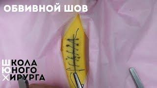 непрерывный обвивной шов (техника; как наложить)