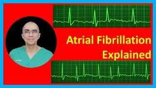 Atrial Fibrillation Explained