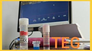 How to do TEG Blood Test | Thrombo Elastro Graphy | TEG | Hemostasis | OT Technician | OT