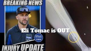 Tomac Fibalua Injury / We lost Great SX Seasoin in 2 weeks 