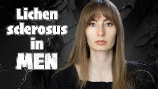 Lichen sclerosus in men