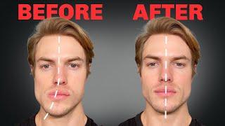 How to Fix Asymmetrical Jaw & Face (FOREVER)