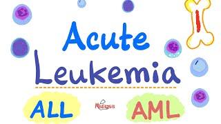 Acute Leukemia - ALL and AML - Hematology and Oncology Series