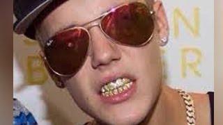 Justin Bieber Gets Golden Teeth