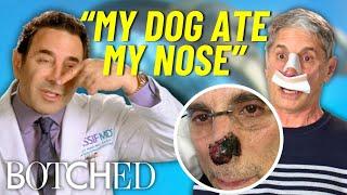 Dr. Nassif Transforms Jim’s Nose After Dog Bite Disaster | Botched | E!