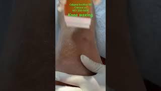 Knee waxing || Honey waxing || original audio #satisfying #shorts #waxing #knee #waxingathome #wax