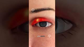 What's REALLY Causing Your Eye Stye?  #shorts #viralvideo - Creativelearning3d