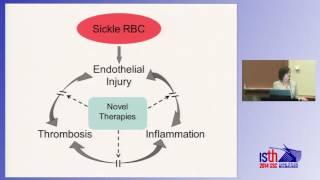 ISTH Academy presentation: Coagulation and Vascular Pathologies in Mouse Models of Sickle Cell