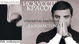 Все самое важное о ринопластике