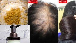 Try this amazing serum for your hair growth,dandruff || Get smooth hair & fast hair growth