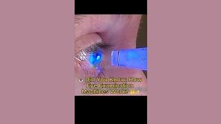 0020.  ️ Did You Know How Eye Examination Machines Work 