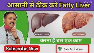 Fatty Liver का ऐसे होगा इलाज, अपनाएं यह साधारण उपाय | Fatty Liver Treatment by Rajiv Dixit