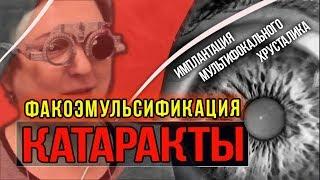  Факоэмульсификация КАТАРАКТЫ в Москве. Имплантация МУЛЬТИФОКАЛЬНОГО ХРУСТАЛИКА. Лечение катаракты