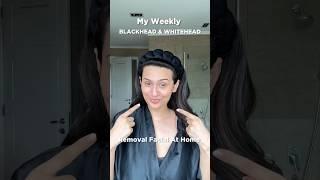 My Blackhead & Whitehead Removal Facial At Home