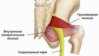 Синдром грушевидной мышцы. Малиновская