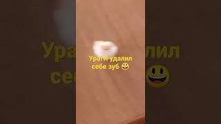 Ура! Я удалил себе зуб 