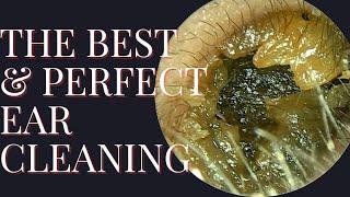 The BEST & PERFECT Ear Cleaning (Satisfying Result At The End)