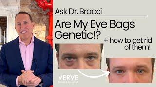 Are Eye-bags Genetic? | Ask Dr. Bracci