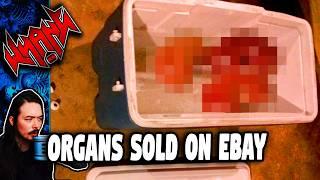 Body Parts Sold on eBay - Tales From the Internet