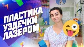 Пластика уздечки лазером в стоматологии Доктор Келлер