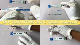 HOW TO | HIV, HEPATITIS B & C strip TESTS yourself at HOME!