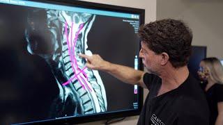 Symptoms of Cervical Stenosis | Jeffrey Cantor, MD