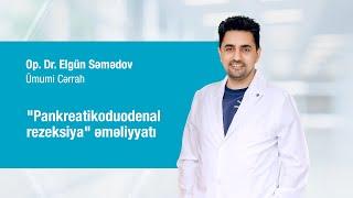 Ümumi Cərrah Op.Dr.Elgün Səmədov "Pankreatikoduodenal rezeksiya" əməliyyatı