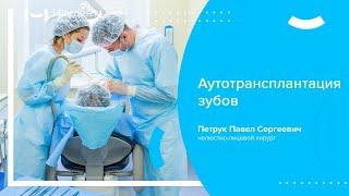 ↪ Аутотрансплантация зубов